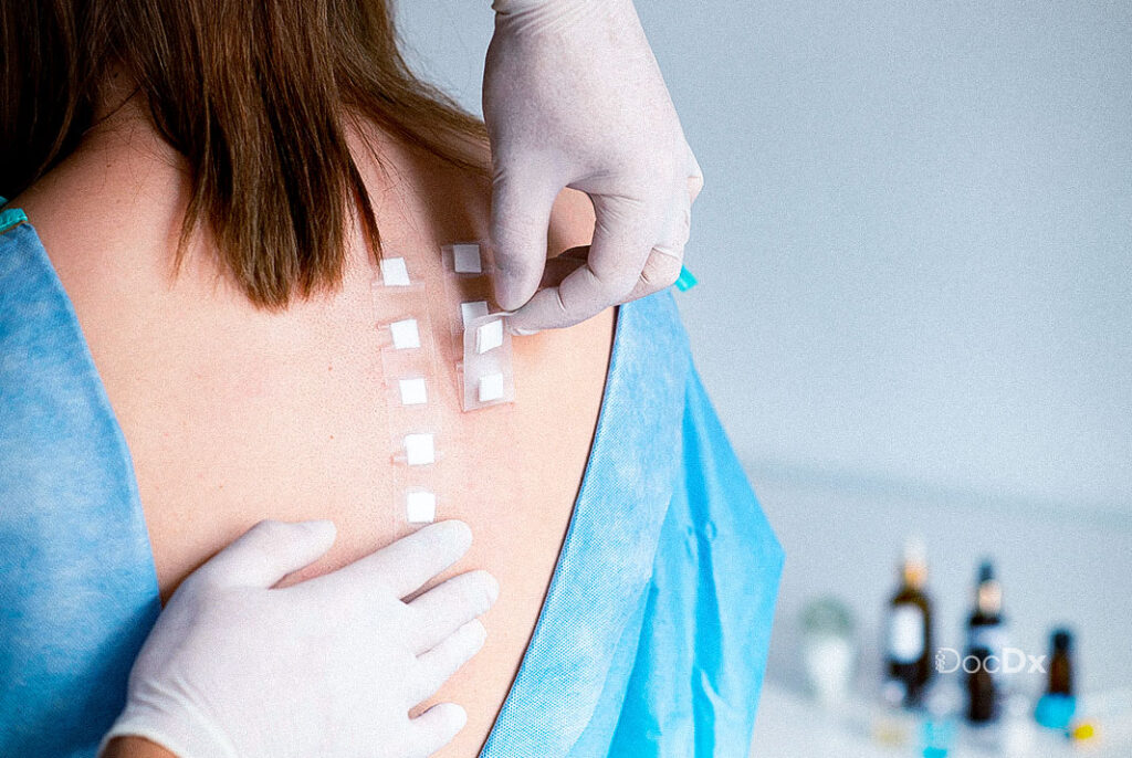 Allergy test