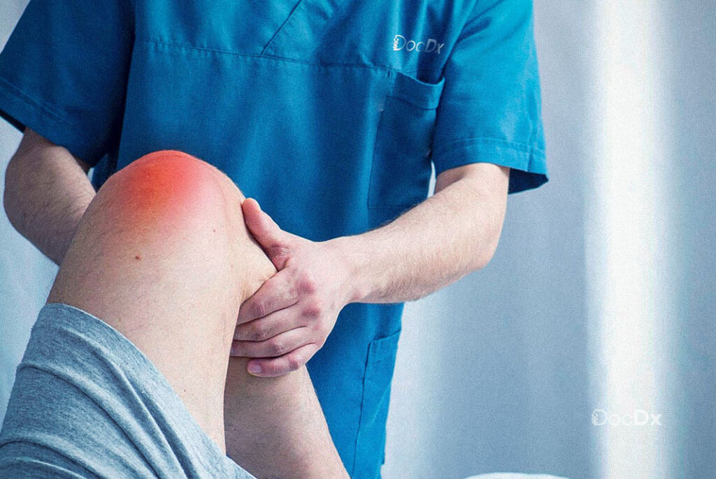 arthritis pain relief