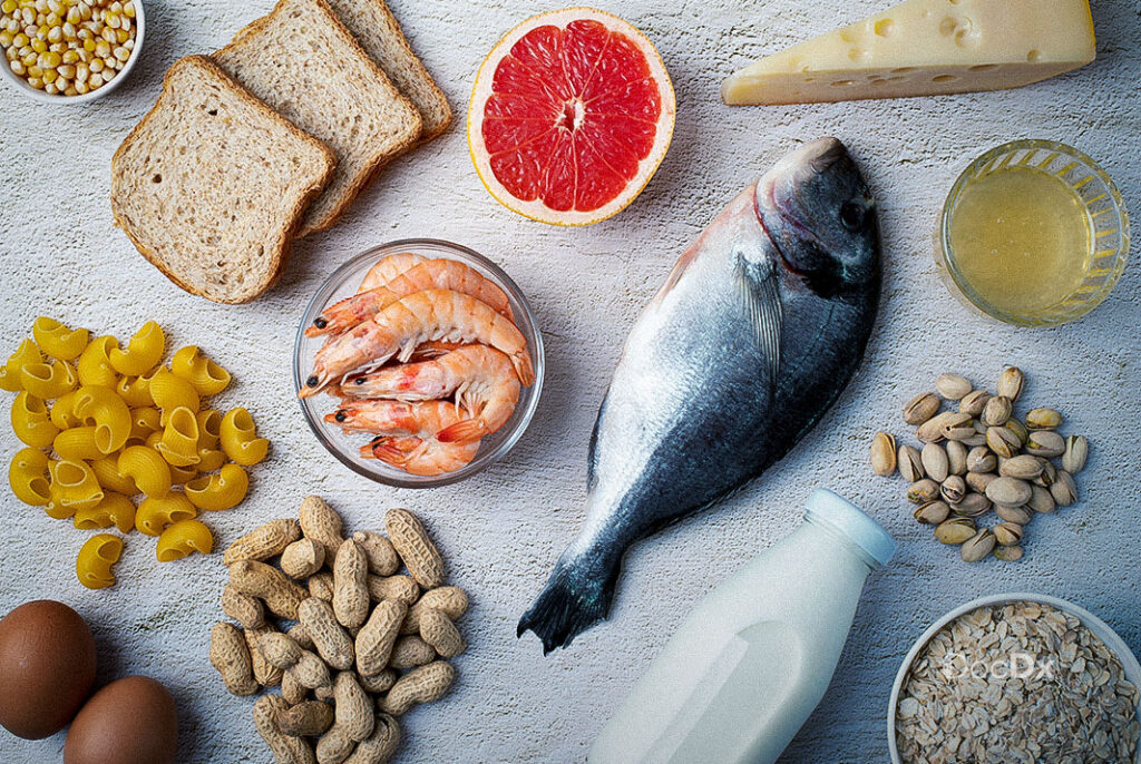 Food Allergies