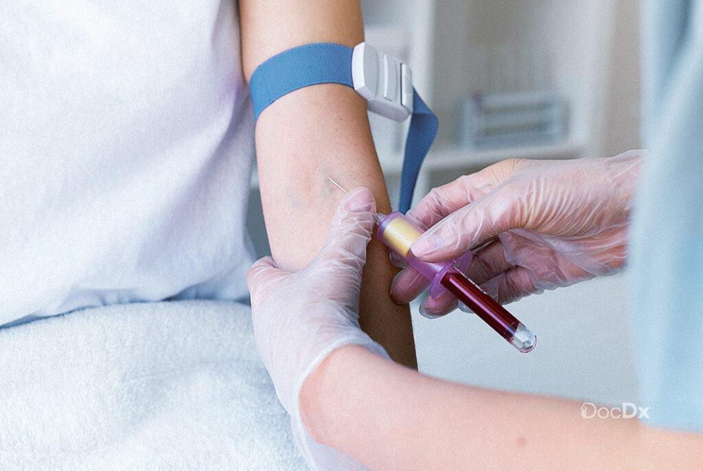 The Role of Blood Tests in Your Pre Surgery Evaluation